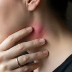 림프 마사지 부작용 증상과 대처법